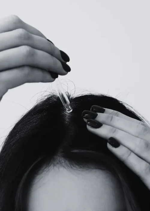 a close up image of woman putting oil hair drops on the scalp as part of healthy hair practices